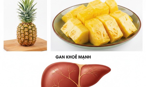 3 thay đổi bất ngờ của cơ thể khi ăn dứa thường xuyên