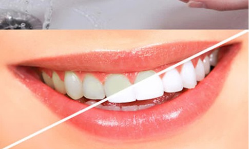 5 cách giúp trắng răng, giữ hơi thở thơm tho - bạn đã biết chưa?