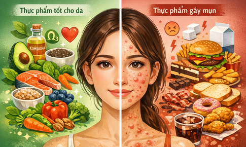 Ăn gì để da sạch mụn, mịn màng?