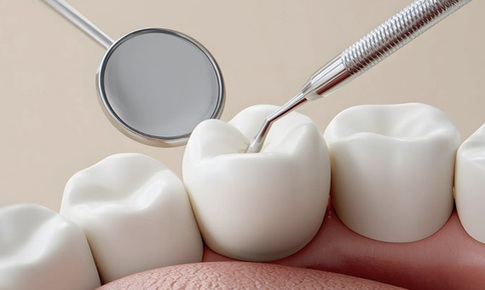 Vi phạm trong lĩnh vực y tế, 4 cơ sở nha khoa ở Lâm Đồng bị xử phạt 143 triệu đồng