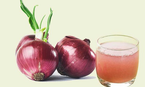 Nước ép hành tây có giúp tóc mọc nhanh hơn?