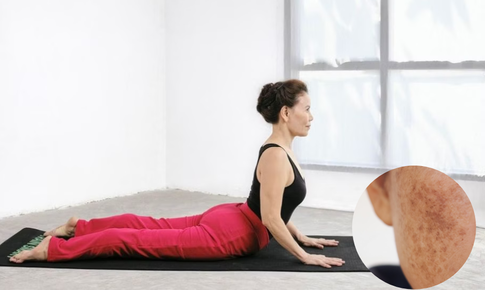 5 tư thế yoga đơn giản hỗ trợ làm mờ nám da tại nhà