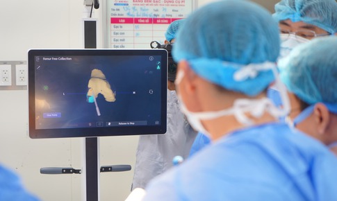 Thoái hóa khớp gối giai đoạn cuối được thay khớp bằng robot, người bệnh sớm đi lại sau mổ