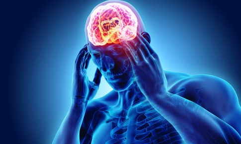 6 bí quyết giúp phòng ngừa đau đầu