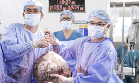 Bụng to bất thường, cô gái 25 tuổi phát hiện u xơ tử cung gần 12kg