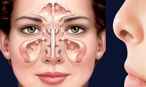 Đau hốc mắt kéo dài, coi chừng viêm xoang trán