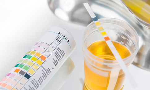 Làm thế nào để nhận biết trẻ bị rối loạn đi tiểu?