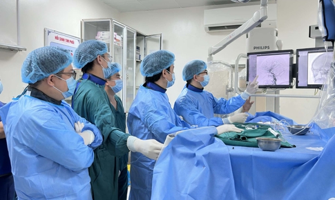 'Giải cứu' mắt lồi do rò động mạch cảnh xoang hang phức tạp bằng can thiệp nội mạch