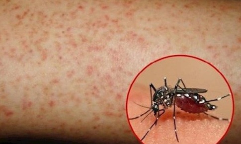 Nguy cơ dịch sốt xuất huyết gia tăng, Lâm Đồng yêu cầu tăng cường giám sát dịch