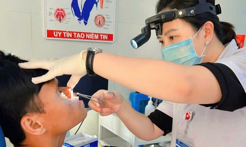 Chảy máu mũi 3 ngày, phát hiện đỉa sống ký sinh