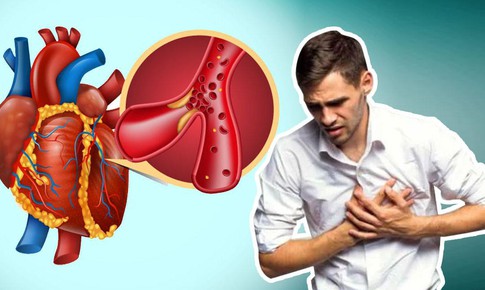 Dấu hiệu cảnh báo bệnh lý tim mạch cần cấp cứu và cách xử trí