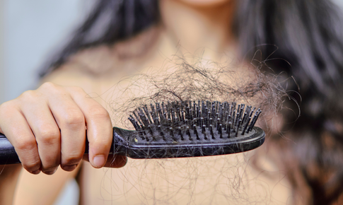 Rụng tóc như thế nào mới đáng lo ?