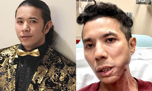 Kasim Hoàng Vũ qua đời sau thời gian bạo bệnh