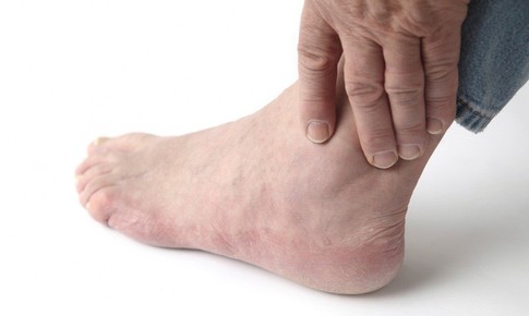 Sai lầm thường gặp chấn thương phần mềm cổ chân