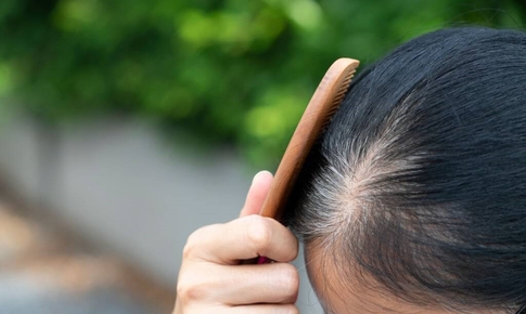 5 thói quen xấu khiến tóc bạc sớm ở người trẻ