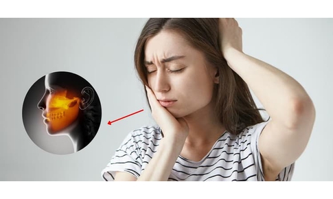 Dinh dưỡng hỗ trợ phòng ngừa biến chứng của viêm khớp thái dương hàm