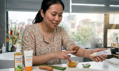 Phục hồi làn da và xóa vết thâm nhanh sau điều trị nấm da