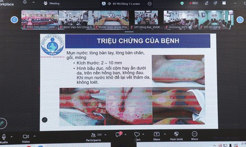 Siết chặt điều trị tay chân miệng: Nâng năng lực hồi sức, đảm bảo cách ly, chuyển tuyến an toàn