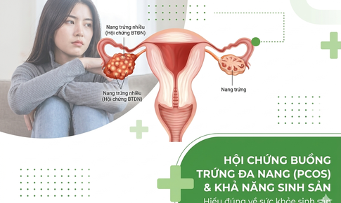 4 cách cải thiện khả năng sinh sản ở phụ nữ mắc Hội chứng buồng trứng đa nang