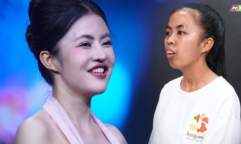 300 giờ phẫu thuật, 120 ngày thay đổi diện mạo: Vì sao chỉnh hàm chưa phải 'điểm kết'?