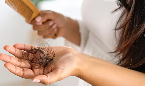 Tại sao tóc rụng nhiều?