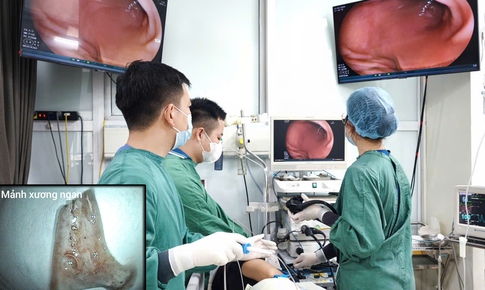 Người đàn ông cấp cứu sau bữa ngan luộc