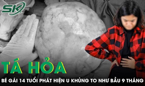 Bé gái 14 tuổi bụng to như bầu 9 tháng, bác sĩ phát hiện u khủng