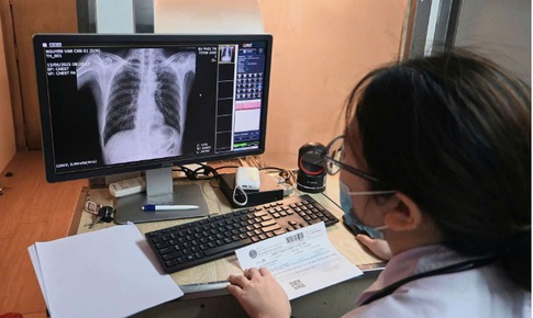 Bệnh viện Phổi Trung ương triển khai xe X-quang lưu động tại Ngày Sức khỏe toàn dân 7/4