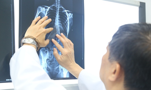 Nhiều trẻ chỉ được phát hiện bệnh khi cột sống đã cong vẹo, chuyên gia khuyến cáo gì đến phụ huynh?