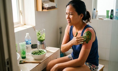 Da cháy nắng và cách dùng rau mồng tơi để xử lý