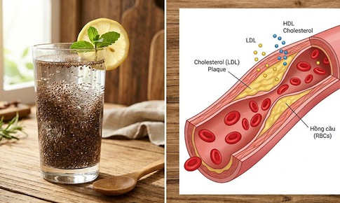 Cách uống nước hạt chia có thể giúp giảm cholesterol và hỗ trợ tim mạch