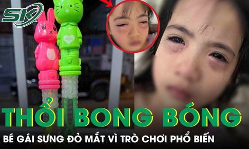 Chơi bong bóng xà phòng, bé gái 5 tuổi sưng đỏ 2 mắt phải cấp cứu khẩn