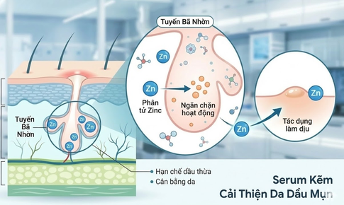 Serum kẽm: 'Chìa khóa' kiểm soát dầu nhờn và giải quyết bài toán mụn viêm