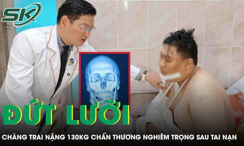 Cứu chàng trai nặng 130 kg đứt lưỡi sau tai nạn giao thông