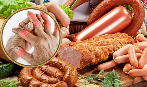 6 loại thực phẩm càng ăn nhiều càng gây đau khớp, viêm khớp