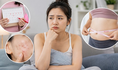 Dấu hiệu buồng trứng đa nang dễ bị bỏ qua