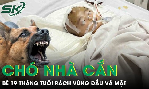 Chó nhà cắn, bé 19 tháng tuổi rách sâu vùng đầu và mặt phải cấp cứu