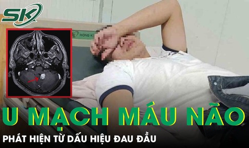 Nam thanh niên phát hiện u mạch máu não xuất huyết từ dấu hiệu đau đầu