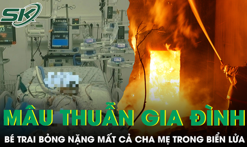 Căn nhà chìm trong biển lửa sau mâu thuẫn gia đình, bé 4 tuổi bỏng hơn 90% cơ thể
