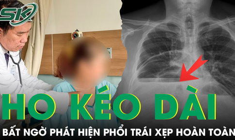 Ho kéo dài nhiều tuần, người phụ nữ bất ngờ phát hiện phổi trái xẹp hoàn toàn vì bệnh hiếm