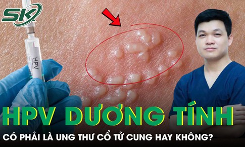 Có phải HPV dương tính là bị ung thư cổ tử cung không?