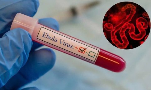 WHO cảnh báo khẩn về Ebola, Bộ Y tế yêu cầu tăng cường giám sát, ngăn dịch xâm nhập