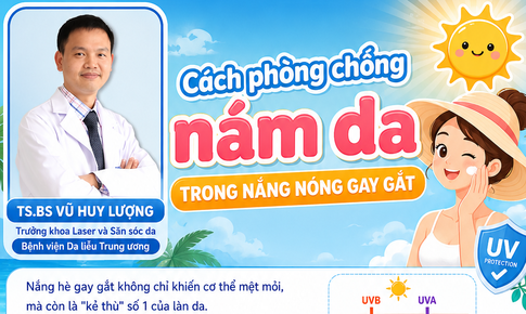 Cách phòng chống nám da, tàn nhang trong nắng nóng gay gắt