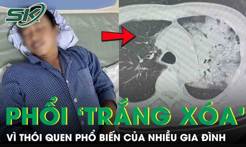 Tưởng cảm cúm, người đàn ông bất ngờ suy đa tạng, phổi ‘trắng xoá’ vì thói quen nhiều người mắc
