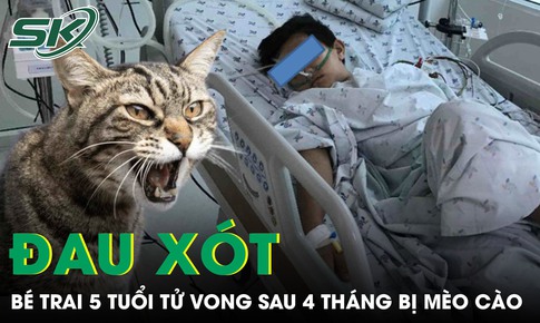 Đau xót: Bé trai 5 tuổi tử vong sau 4 tháng bị mèo cào 
