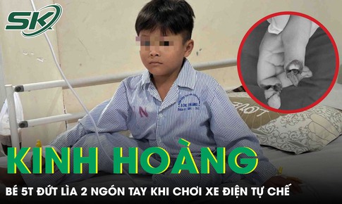 Kinh hoàng: Bé trai 5 tuổi đứt lìa 2 ngón tay khi chơi xe điện tự chế