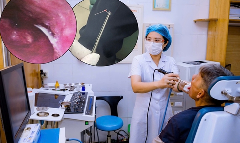 Hi hữu hóc lông lợn sau khi ăn bánh mỳ pate