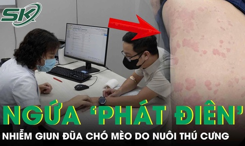 Ngứa ‘phát điên’, người đàn ông đi khám phát hiện nhiễm giun đũa chó mèo 