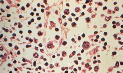 Đài Loan (Trung Quốc) ghi nhận 1 ca tử vong do nhiễm virus Hanta