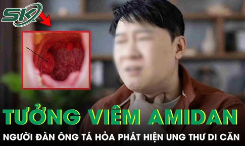 Tưởng viêm amidan, người đàn ông 60 tuổi 'chết lặng' phát hiện ung thư di căn